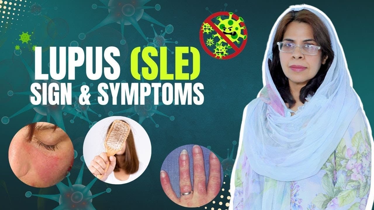 Systemic Lupus Erythematosus (SLE) Symptoms