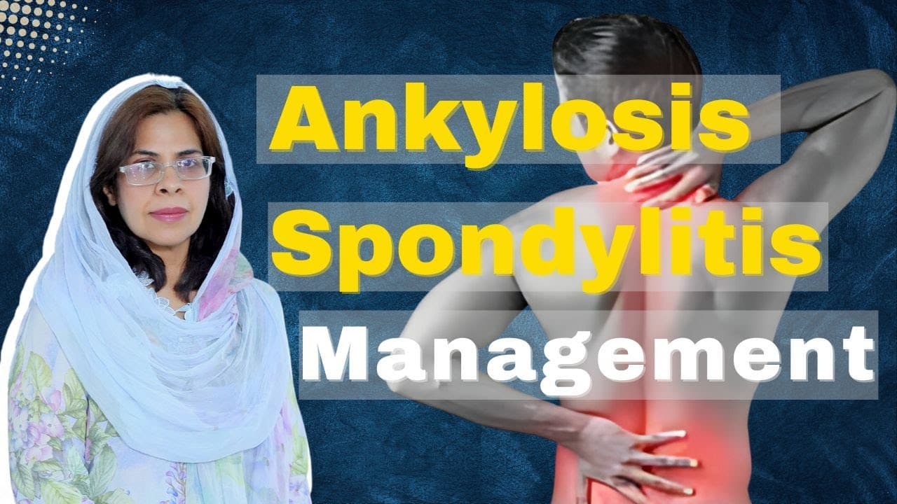Management of Ankylosing Spondylitis