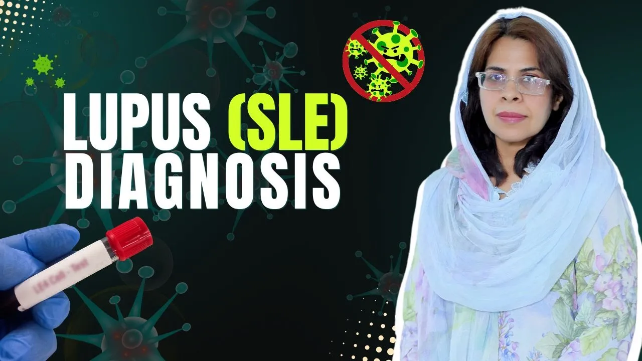 Diagnosis of Systemic Lupus Erythematosus (SLE)