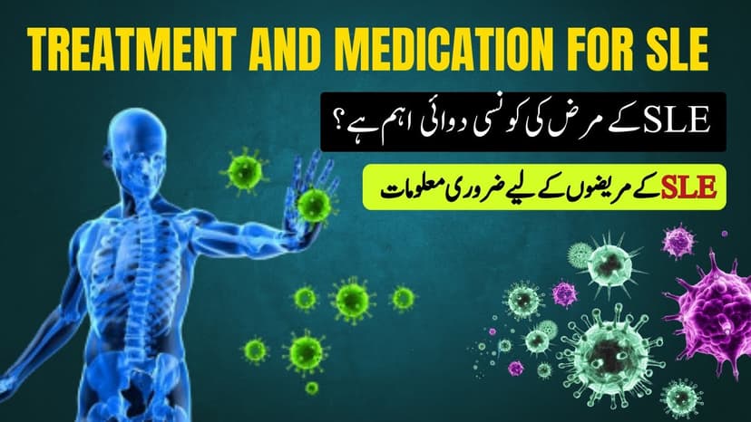 Lupus (SLE) Treatment & Medication