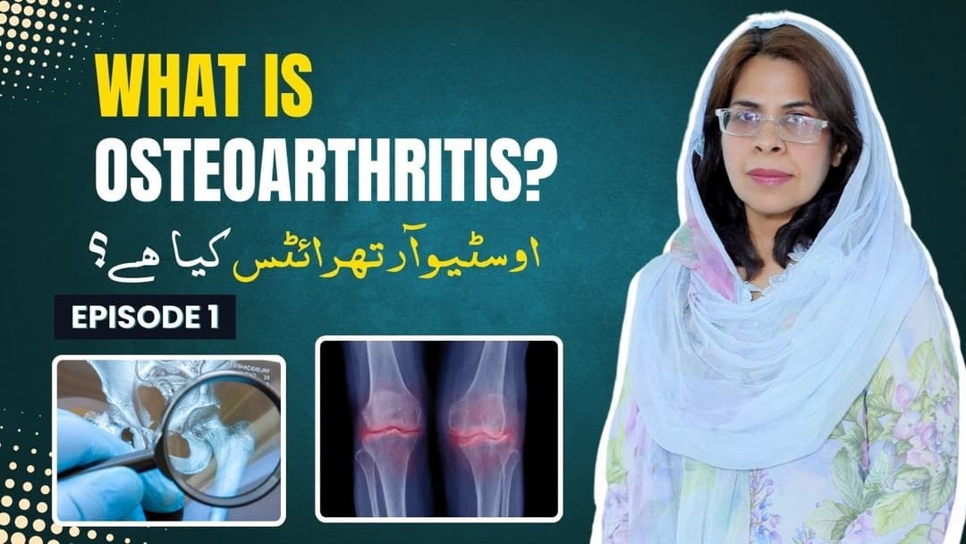 Osteoarthritis treatment in Faisalabad by Dr. Naseem Arshad